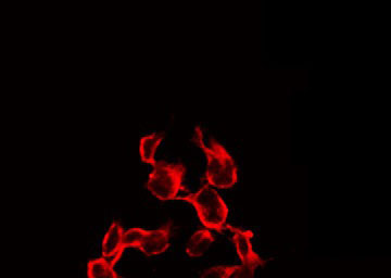 IGF1R / IGF1 Receptor Antibody - Staining 293 cells by IF/ICC. The samples were fixed with PFA and permeabilized in 0.1% Triton X-100, then blocked in 10% serum for 45 min at 25°C. The primary antibody was diluted at 1:200 and incubated with the sample for 1 hour at 37°C. An Alexa Fluor 594 conjugated goat anti-rabbit IgG (H+L) Ab, diluted at 1/600, was used as the secondary antibody.