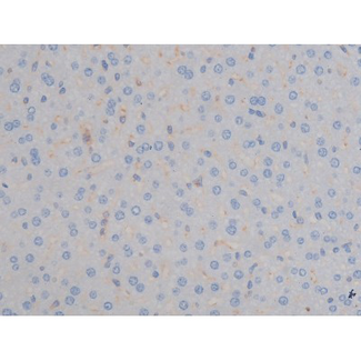IGF1R / IGF1 Receptor Antibody - 1:200 staining mouse liver tissue by IHC-P. The tissue was formaldehyde fixed and a heat mediated antigen retrieval step in citrate buffer was performed. The tissue was then blocked and incubated with the antibody for 1.5 hours at 22°C. An HRP conjugated goat anti-rabbit antibody was used as the secondary.