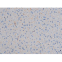 IGF1R / IGF1 Receptor Antibody - 1:200 staining mouse liver tissue by IHC-P. The tissue was formaldehyde fixed and a heat mediated antigen retrieval step in citrate buffer was performed. The tissue was then blocked and incubated with the antibody for 1.5 hours at 22°C. An HRP conjugated goat anti-rabbit antibody was used as the secondary.