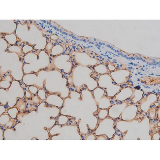 IGF1R / IGF1 Receptor Antibody - 1:200 staining mouse lung tissue by IHC-P. The tissue was formaldehyde fixed and a heat mediated antigen retrieval step in citrate buffer was performed. The tissue was then blocked and incubated with the antibody for 1.5 hours at 22°C. An HRP conjugated goat anti-rabbit antibody was used as the secondary.