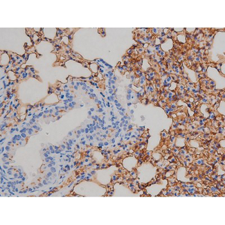 IGF1R / IGF1 Receptor Antibody - 1:200 staining mouse lung tissue by IHC-P. The tissue was formaldehyde fixed and a heat mediated antigen retrieval step in citrate buffer was performed. The tissue was then blocked and incubated with the antibody for 1.5 hours at 22°C. An HRP conjugated goat anti-rabbit antibody was used as the secondary.