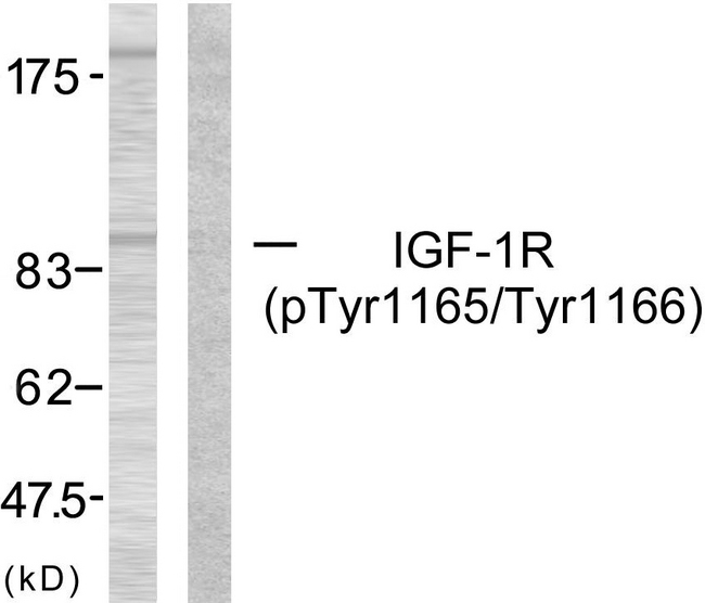IGF1R / IGF1 Receptor Antibody - Western blot analysis of lysates from 293 cells treated with Insulin, using IGF1R (Phospho-Tyr1165/Tyr1166) Antibody. The lane on the right is blocked with the phospho peptide.
