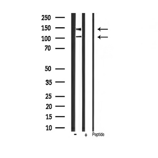 IGF1R / IGF1 Receptor Antibody - Western blot analysis of IGF1R phosphorylation expression in mouse brain tissue lysates. The lane on the right is treated with the antigen-specific peptide.