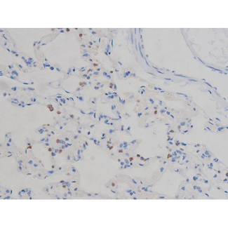 IGF1R / IGF1 Receptor Antibody - 1:200 staining rat lung tissue by IHC-P. The tissue was formaldehyde fixed and a heat mediated antigen retrieval step in citrate buffer was performed. The tissue was then blocked and incubated with the antibody for 1.5 hours at 22°C. An HRP conjugated goat anti-rabbit antibody was used as the secondary.