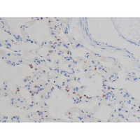 IGF1R / IGF1 Receptor Antibody - 1:200 staining rat lung tissue by IHC-P. The tissue was formaldehyde fixed and a heat mediated antigen retrieval step in citrate buffer was performed. The tissue was then blocked and incubated with the antibody for 1.5 hours at 22°C. An HRP conjugated goat anti-rabbit antibody was used as the secondary.