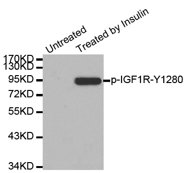 IGF1R / IGF1 Receptor Antibody - Western blot analysis of extract from 293 cells.