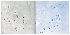 IGF1R / IGF1 Receptor Antibody - Immunohistochemistry analysis of paraffin-embedded human brain, using IGF1R (Phospho-Tyr1346) Antibody. The picture on the right is blocked with the phospho peptide.