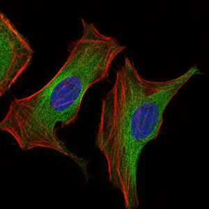 IGF2 Antibody - Immunofluorescence of HeLa cells using IGF2 mouse monoclonal antibody (green). Blue: DRAQ5 fluorescent DNA dye. Red: Actin filaments have been labeled with Alexa Fluor-555 phalloidin.