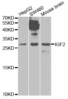 IGF2 Antibody - Western blot analysis of extracts of various cell lines, using IGF2 antibody.