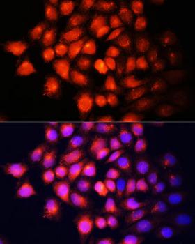 IGF2 Antibody - Immunofluorescence analysis of HeLa cells using IGF2 Polyclonal Antibody at dilution of 1:100 (40x lens).Blue: DAPI for nuclear staining.