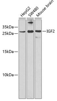 IGF2 Antibody - Western blot analysis of extracts of various cell lines using IGF2 Polyclonal Antibody at dilution of 1:1000.