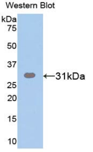 IGF2BP2 Antibody - Western blot of recombinant IGF2BP2.  This image was taken for the unconjugated form of this product. Other forms have not been tested.