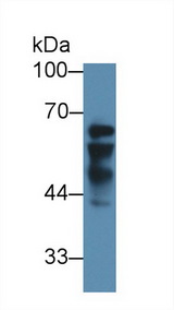 IGF2BP2 Antibody - Western Blot; Sample: Human Liver lysate; Primary Ab: 3µg/ml Rabbit Anti-Human IGF2BP2 Antibody Second Ab: 0.2µg/mL HRP-Linked Caprine Anti-Rabbit IgG Polyclonal Antibody