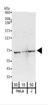 IGF2BP2 Antibody - Detection of IGF2BP2 by Western Blot. Samples: Whole Cell Lysate from HeLa (15 and 50 ug) and Jurkat (J; 50 ug) cells for WB. Antibodies: Purified mouse monoclonal anti-IGF2BP2 antibody was used at 0.04 ug/ml for WB. Detection: Chemiluminescence with an exposure time of 3 minutes.
