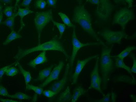 IGF2BP2 Antibody - Immunofluorescent staining of HeLa cells using anti-IGF2BP2 mouse monoclonal antibody.