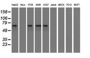IGF2BP2 Antibody - Western blot analysis of extracts (35ug) from 9 different cell lines by using anti-IGF2BP2 monoclonal antibody.
