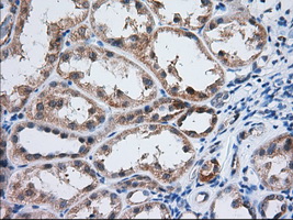 IGF2BP2 Antibody - Immunohistochemical staining of paraffin-embedded Human Kidney tissue using anti-IGF2BP2 mouse monoclonal antibody. (Dilution 1:50).