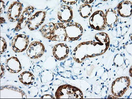IGF2BP2 Antibody - Immunohistochemical staining of paraffin-embedded Human Kidney tissue within the normal limits using anti-IGF2BP2 mouse monoclonal antibody. (Heat-induced epitope retrieval by 10mM citric buffer, pH6.0, 100C for 10min, Dilution 1:50)