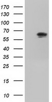 IGF2BP2 Antibody - HEK293T cells were transfected with the pCMV6-ENTRY control. (Left lane) or pCMV6-ENTRY IGF2BP2. (Right lane) cDNA for 48 hrs and lysed