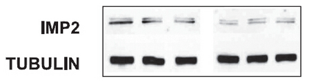 IGF2BP2 Antibody - Figure from citation: Western Blot of IGF2BP2(IMP2) protein level by using anti-IGF2BP2 antibody in rat glomerular MCs.