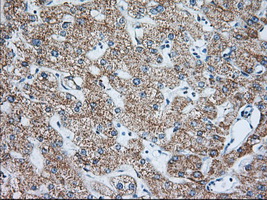 IGF2BP2 Antibody - Immunohistochemical staining of paraffin-embedded Human liver tissue within the normal limits using anti-IGF2BP2 mouse monoclonal antibody. (Heat-induced epitope retrieval by 10mM citric buffer, pH6.0, 100C for 10min, Dilution 1:50)