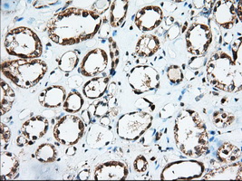 IGF2BP2 Antibody - IHC of paraffin-embedded Human Kidney tissue using anti-IGF2BP2 mouse monoclonal antibody. (Dilution 1:50).