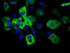 IGF2BP2 Antibody - Anti-IGF2BP2 mouse monoclonal antibody immunofluorescent staining of COS7 cells transiently transfected by pCMV6-ENTRY IGF2BP2.