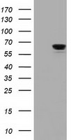 IGF2BP2 Antibody - HEK293T cells were transfected with the pCMV6-ENTRY control (Left lane) or pCMV6-ENTRY IGF2BP2 (Right lane) cDNA for 48 hrs and lysed. Equivalent amounts of cell lysates (5 ug per lane) were separated by SDS-PAGE and immunoblotted with anti-IGF2BP2.