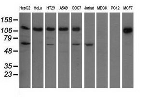 IGF2BP2 Antibody - Western blot of extracts (35 ug) from 9 different cell lines by using anti-IGF2BP2 monoclonal antibody.