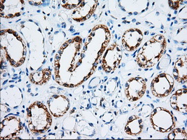 IGF2BP2 Antibody - IHC of paraffin-embedded Human Kidney tissue using anti-IGF2BP2 mouse monoclonal antibody. (Dilution 1:50).