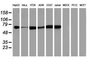 IGF2BP2 Antibody - Western blot of extracts (35 ug) from 9 different cell lines by using anti-IGF2BP2 monoclonal antibody.