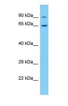 IGF2BP2 Antibody - Western blot of IGF2BP2 Antibody with PANC1 Whole Cell lysate.  This image was taken for the unconjugated form of this product. Other forms have not been tested.