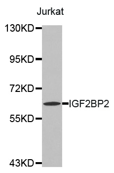 IGF2BP2 Antibody - Western blot analysis of extracts of Jurkat cells.