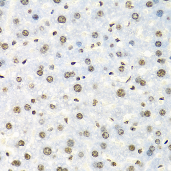IGF2BP2 Antibody - Immunohistochemistry of paraffin-embedded mouse liver tissue.