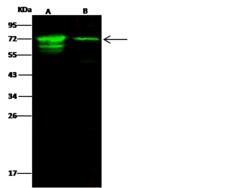 IGF2BP2 Antibody - Anti-IGF2BP2 rabbit polyclonal antibody at 1:500 dilution. Lane A: HepG2 Whole Cell Lysate. Lane B: Jurkat Whole Cell Lysate. Lysates/proteins at 30 ug per lane. Secondary: Goat Anti-Rabbit IgG H&L (Dylight 800) at 1/10000 dilution. Developed using the Odyssey technique. Performed under reducing conditions. Predicted band size: 66 kDa. Observed band size: 72 kDa. (We are unsure as to the identity of these extra bands.)