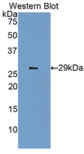 IGF2R / CD222 Antibody - Western Blot; Sample: Recombinant protein.