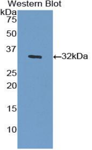 IGF2R / CD222 Antibody - Western blot of recombinant IGF2R / CD222.  This image was taken for the unconjugated form of this product. Other forms have not been tested.