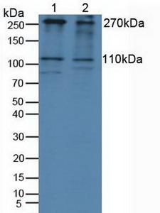 IGF2R / CD222 Antibody - Western Blot; Sample: Lane1: Human 293T Cells; Lane2: Human HepG2 Cells.