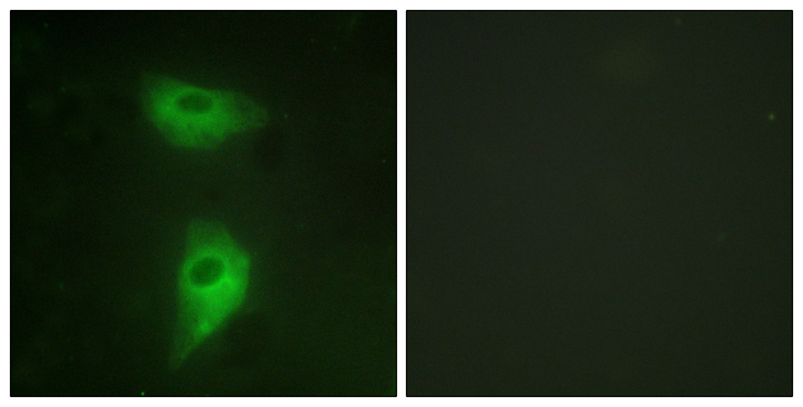 IGF2R / CD222 Antibody - Immunofluorescence analysis of HeLa cells, using IGF2R Antibody. The picture on the right is blocked with the synthesized peptide.