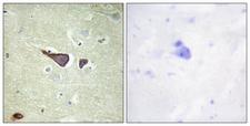 IGF2R / CD222 Antibody - Immunohistochemistry analysis of paraffin-embedded human brain tissue, using IGF2R Antibody. The picture on the right is blocked with the synthesized peptide.