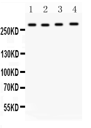 IGF2R / CD222 Antibody - Anti-Mannose 6 Phosphate Receptor(Cation independent) antibody, Western blotting All lanes: Anti Mannose 6 Phosphate Receptor (Cation independent) at 0.5ug/ml Lane 1: HELA Whole Cell Lysate at 40ugLane 2: JURKAT Whole Cell Lysate at 40ugLane 3: 22RV1 Whole Cell Lysate at 40ugLane 4: 293T Whole Cell Lysate at 40ugPredicted bind size: 274KD Observed bind size: 274KD