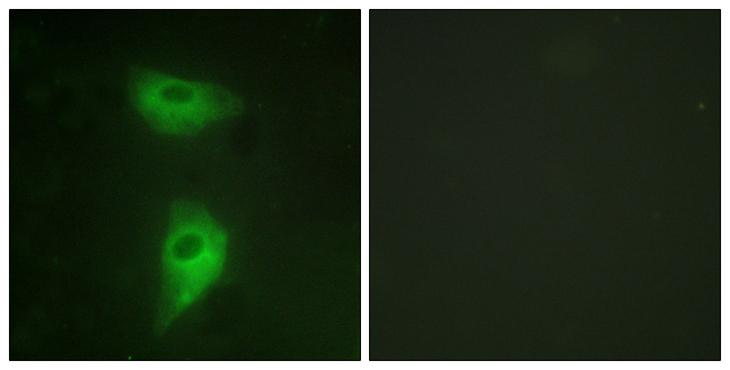 IGF2R / CD222 Antibody - Peptide - + Immunofluorescence analysis of HeLa cells, using IGF2R antibody.