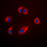 IGF2R / CD222 Antibody - Immunofluorescent analysis of CD222 staining in Jurkat cells. Formalin-fixed cells were permeabilized with 0.1% Triton X-100 in TBS for 5-10 minutes and blocked with 3% BSA-PBS for 30 minutes at room temperature. Cells were probed with the primary antibody in 3% BSA-PBS and incubated overnight at 4 ??C in a humidified chamber. Cells were washed with PBST and incubated with a DyLight 594-conjugated secondary antibody (red) in PBS at room temperature in the dark. DAPI was used to stain the cell nuclei (blue).