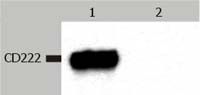 IGF2R / CD222 Antibody - IGF2R Antibody in Western Blot (WB)