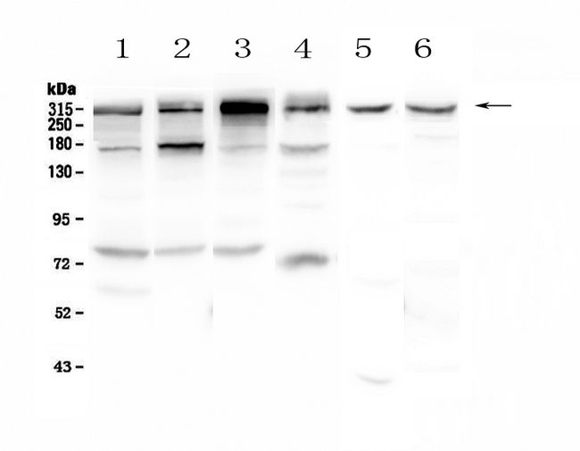 IGF2R / CD222 Antibody - Western blot - Anti-IGF2R Picoband antibody
