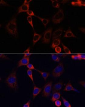 IGF2R / CD222 Antibody - Immunofluorescence analysis of NIH/3T3 cells using IGF2R antibody at dilution of 1:100. Blue: DAPI for nuclear staining.