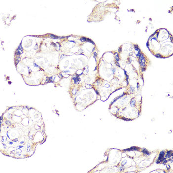 IGF2R / CD222 Antibody - Immunohistochemistry of paraffin-embedded human placenta using IGF2R antibody at dilution of 1:100 (40x lens).