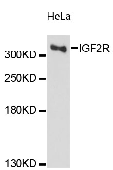 IGF2R / CD222 Antibody - Western blot analysis of extracts of HeLa cells, using IGF2R antibody at 1:3000 dilution. The secondary antibody used was an HRP Goat Anti-Rabbit IgG (H+L) at 1:10000 dilution. Lysates were loaded 25ug per lane and 3% nonfat dry milk in TBST was used for blocking. An ECL Kit was used for detection and the exposure time was 90s.