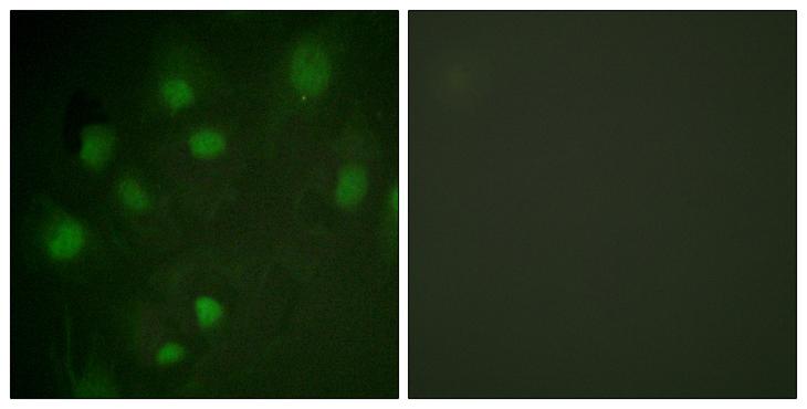 IGF2R / CD222 Antibody - Peptide - + Immunofluorescence analysis of HeLa cells, using IGF2R antibody.