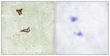 IGF2R / CD222 Antibody - Immunohistochemistry analysis of paraffin-embedded human brain, using IGF2R (Phospho-Ser2409) Antibody. The picture on the right is blocked with the phospho peptide.